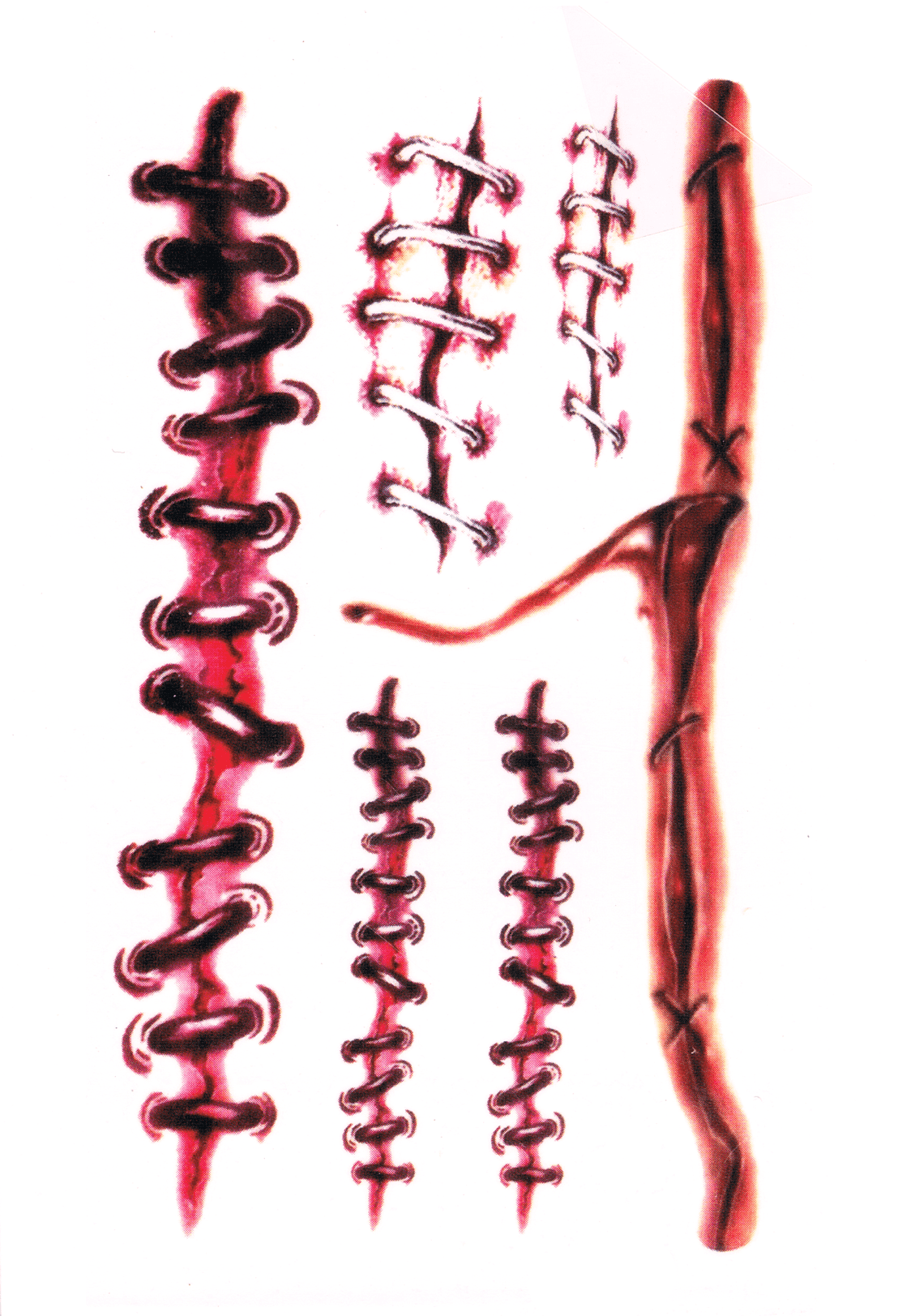 Cicatrices ( 6 pièces )