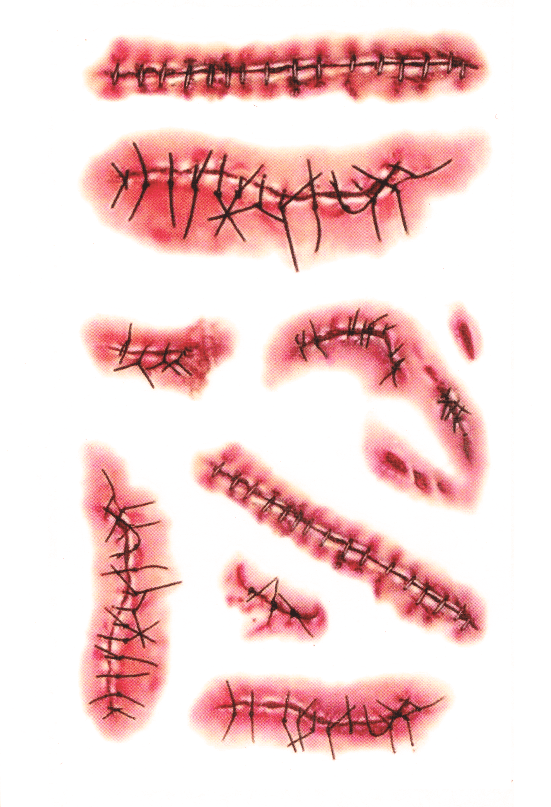 Cicatrices ( 8 pièces )