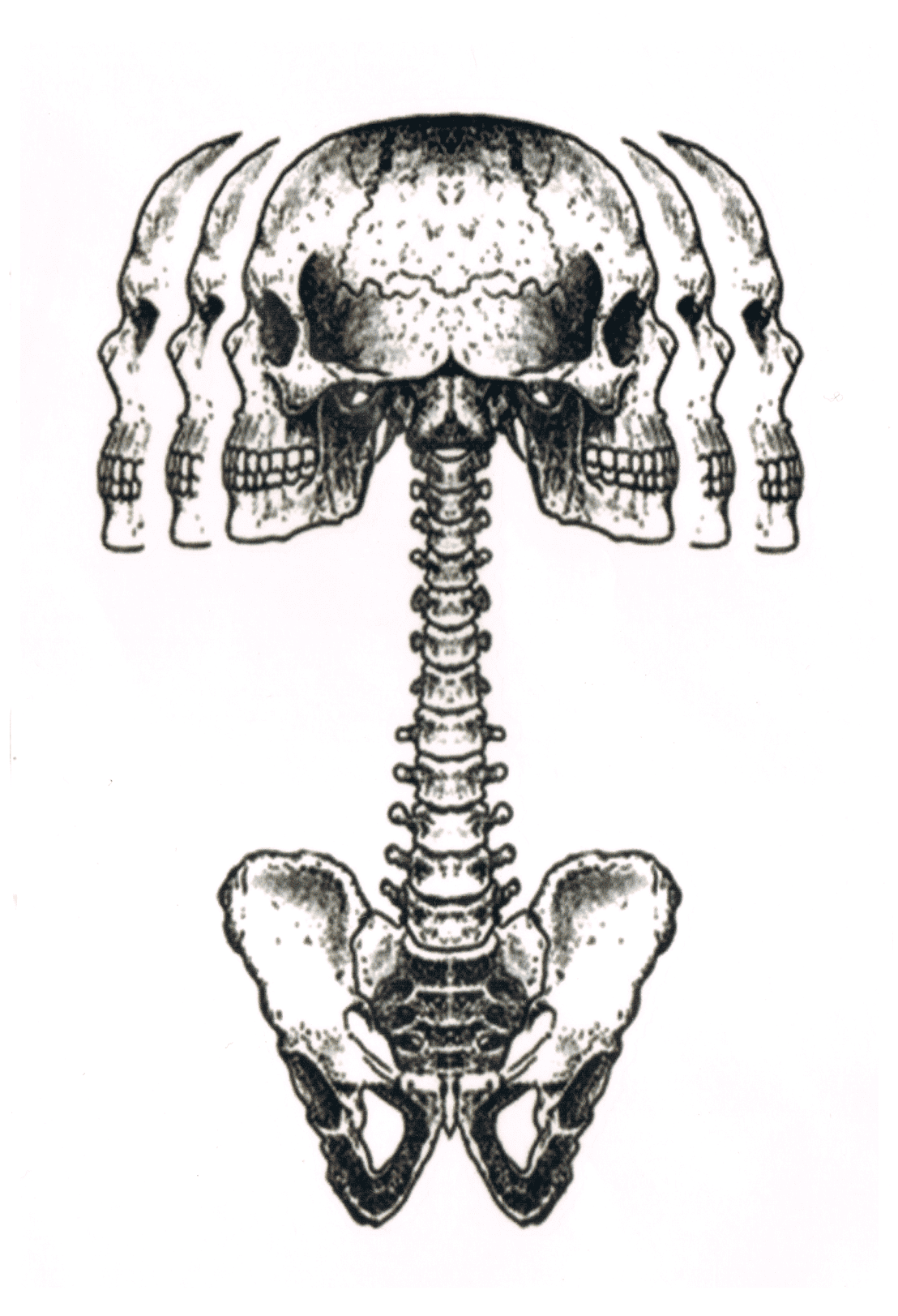 Distorsion Crânienne